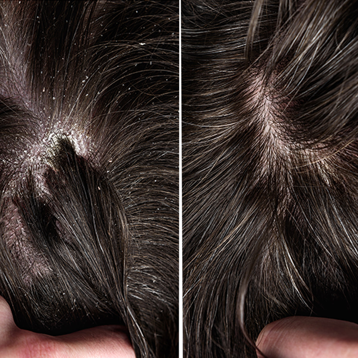 Dry-Scalp-Shampoo-for-Men