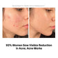 SkinVitalizing Serum